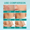 Scar Removal Spray